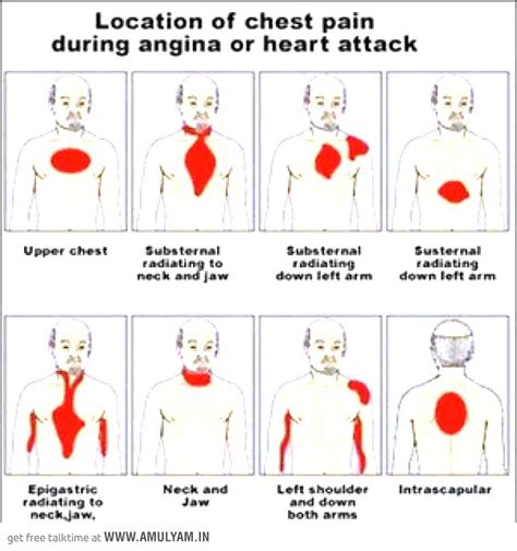 It might have a different cardiac cause or be totally unrelated to your heart. Location of Chest Pain during heart attack