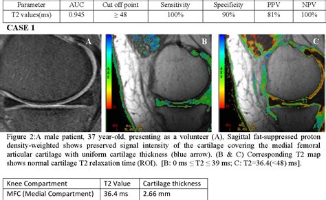 Figure 2 From Role Of Mri T2 Mapping In Assessment Of Articular Knee