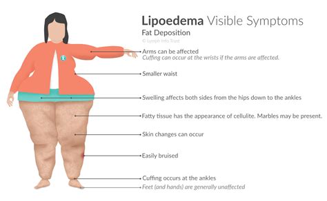 Lipoedema And Fat Deposition Lymph Info Trust