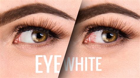 How To Get Rid Of Bloodshot Red Eyes And Clean Up Eye Whites In