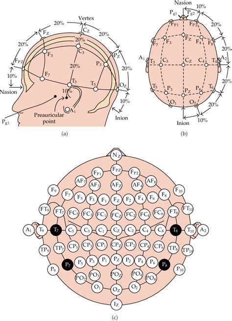 Figure 1 From Hyperspherical Manifold For Eeg Signals Of Epileptic
