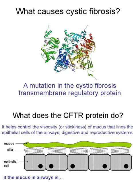 What Causes Cystic Fibrosis A Mutation In The Cystic Fibrosis