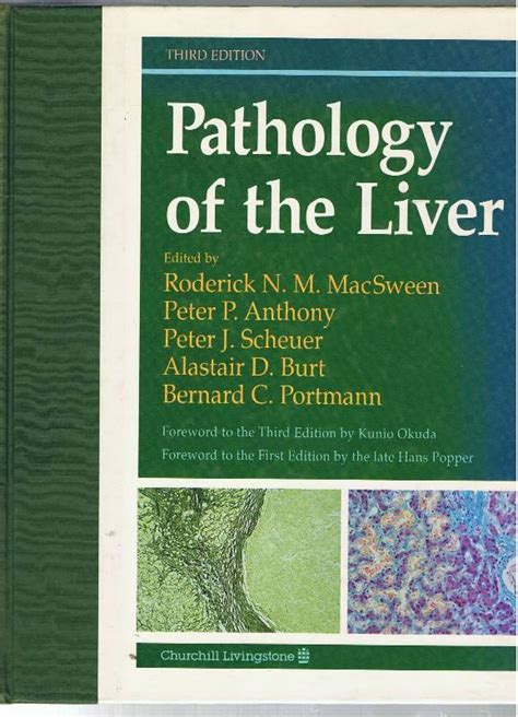 Pathology Of The Liver De Macsween Roderick Anthony Peter