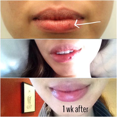 What Is The Meaning Of Mole On Lips | Lipstutorial.org