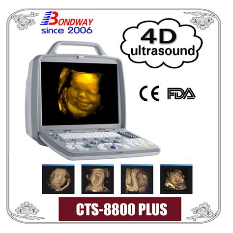 4d Portable Ultrasound Scanner With Thi Pwd Compound Imaging