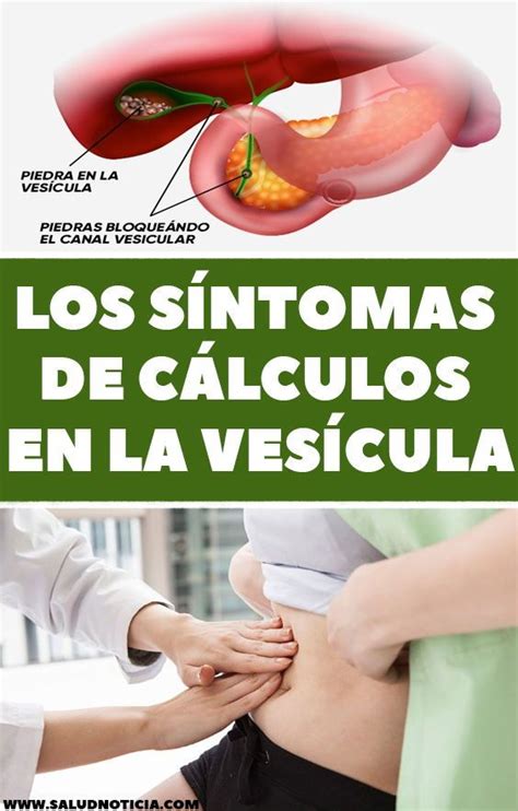 Causas Y Sintomas De Los Calculos De La Vesicula Biliar Youtube Images