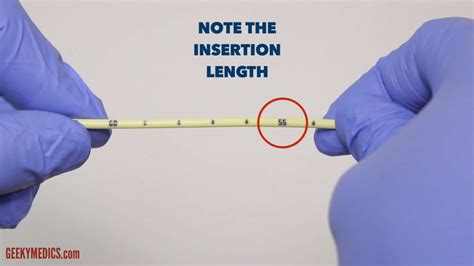 Nasogastric Ng Tube Insertion Osce Guide Geeky Medics