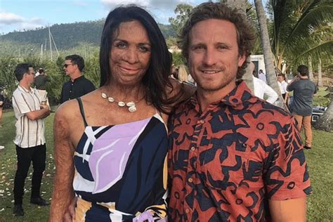 Turia Pitt On Her Love Story With Michael Hoskin