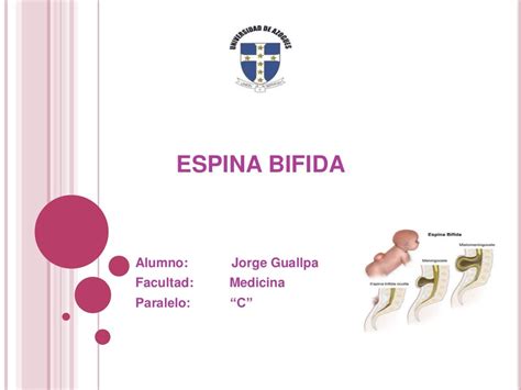 Espina Bifida