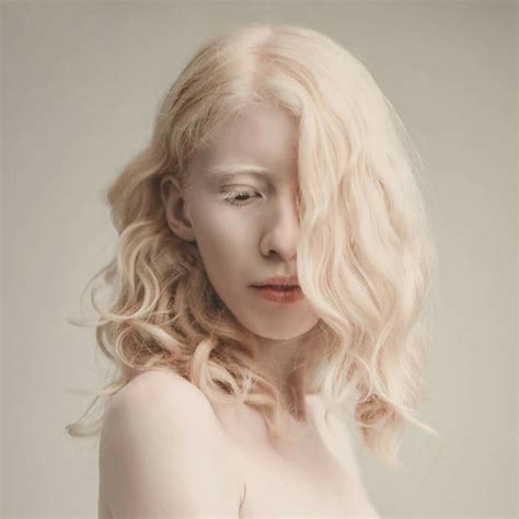 Modelos Albinos Que Demuestran Que Lo Diferente Es Igualmente Bello