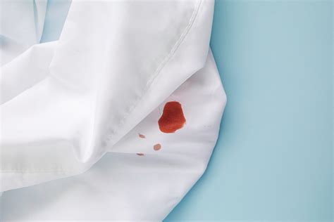 How To Get Blood Out Of Sheets — Steps To Remove Fresh Or Dried Blood