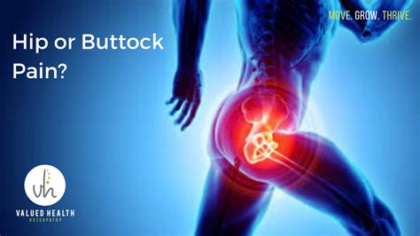 Hip Or Buttock Pain Could It Be Trochanteric Bursitis
