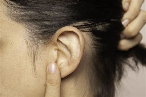 耳朵有折痕就有心脏病？谣言！但出现这些情况要警惕财经头条