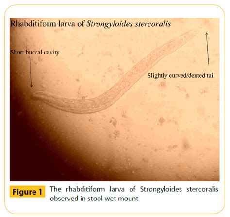 Human Strongyloidiasis An Insight In To A Neglected Tropical Parasitic