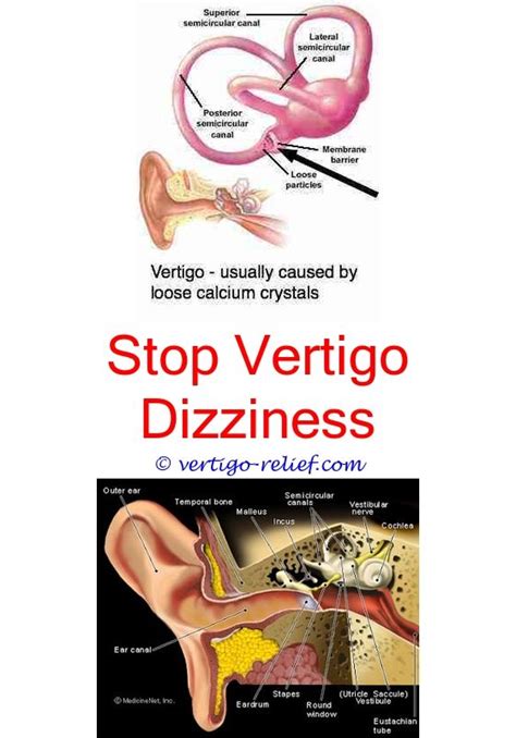 Dizziness And Vertigo And Nausea Vertigo Treatment Vertigo Relief