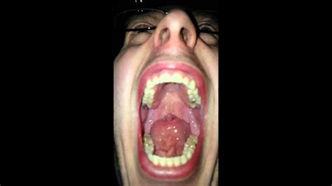 Uvula Vs Tongue Youtube