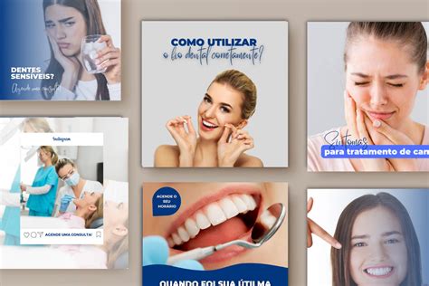 50 Posts Editáveis Para Odontologia 001 Verônica Lidugério