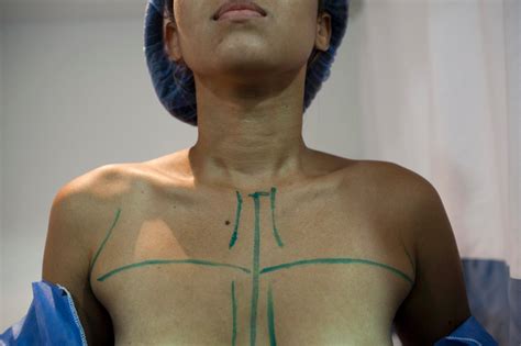 Venezuela S Newest Shortage Breast Implants World News Us News