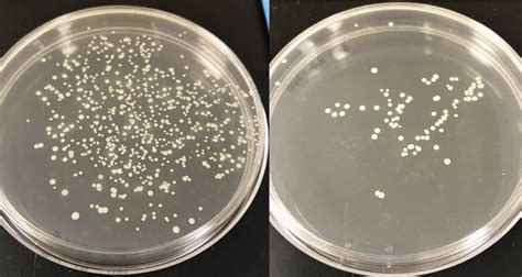 Typical Set Of Agar Plates Showing Microbial Colonies Growing On The