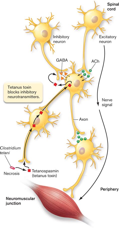 Trial, 'no increased risk' of blood clots. Tetanospasmin mechanism. Tetanospasmin. 2019-01-14
