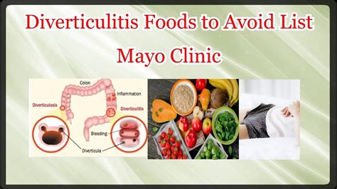 Diverticulitis Foods To Avoid List Mayo Clinic Youtube
