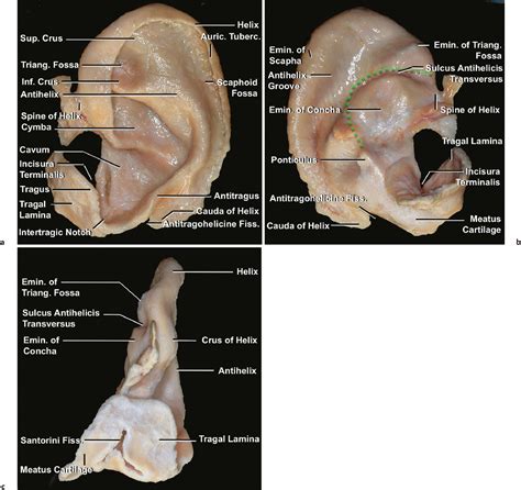 Auricle And External Acoustic Meatus Plastic Surgery Key