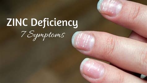 7 Unusual Symptoms Of Zinc Deficiency