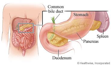 Bert vogelstein, md, says in the report (oct. Pancreatic Cancer: Care Instructions