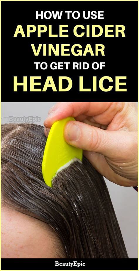 How To Treat Head Lice With Apple Cider Vinegar Head Louse Apple