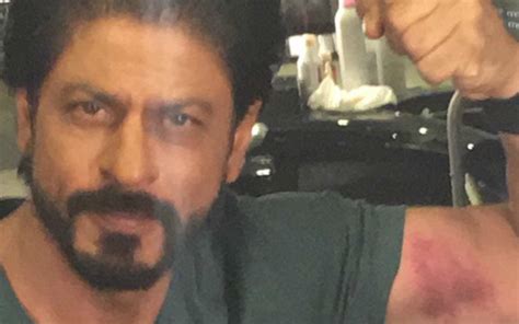 Shah Rukh Khan Flaunts His Love Bite