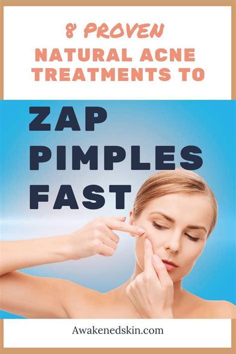 How To Zap Pimples Fast 8 Proven Natural Acne Treatments Natural