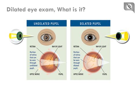 Dilated Eye Exam What Is It A Dilated Vision Exam Allows Your Doctor