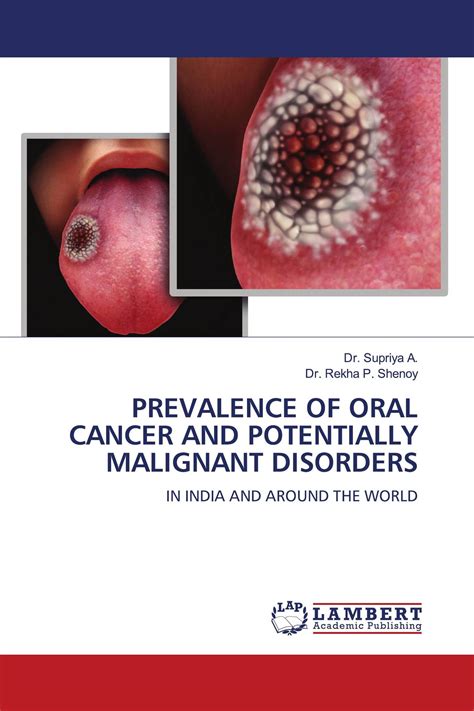Prevalence Of Oral Cancer And Potentially Malignant Disorders 978 620
