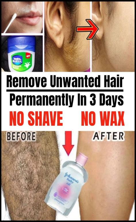 remove unwanted hair permanently in 3 days no shave no wax unwanted hair permanently unwanted