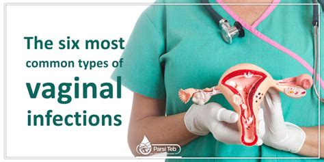 The Six Most Common Types Of Vaginal Infections Parsi Teb