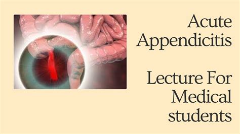 Acute Appendicitis Lecture For Medical Students Mbbs Neet Usmle