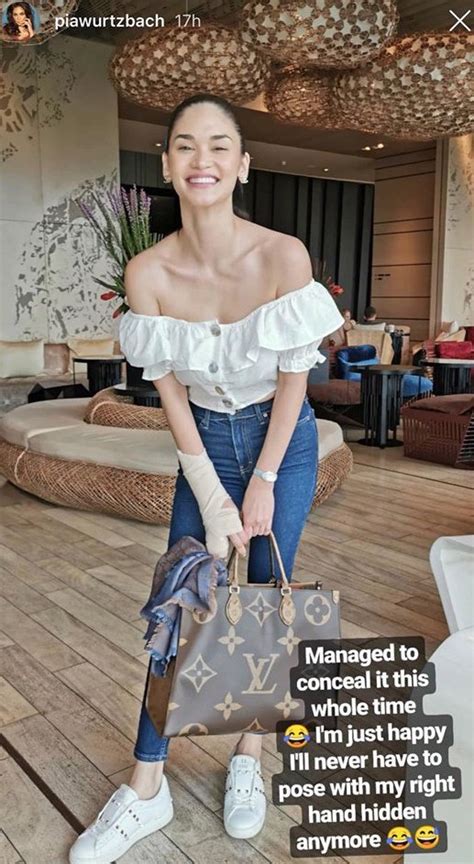 Pia Wurtzbach Recovers From Finger Injury Inquirer Entertainment