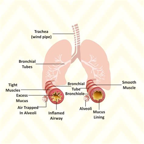 how long can asthma flare up last