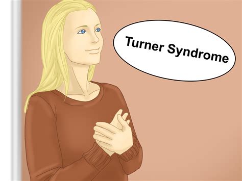 How To Diagnose Turner Syndrome Steps With Pictures The Best