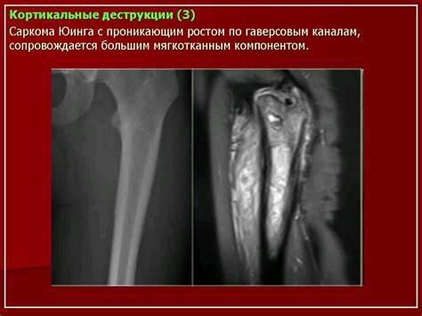 Онкология лечение диета Онкология Саркома 4 Стадия Диета — Похудение Диета Правильное Питание Онкология Саркома 4 Стадия Диета — Похудение Диета Правильное Питание Онкология лечение диета