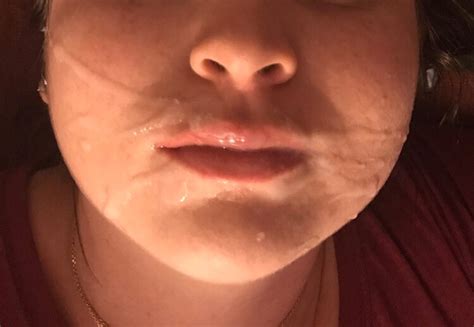 Face Lip Nose Cheek Skin Chin Porn Pic Eporner