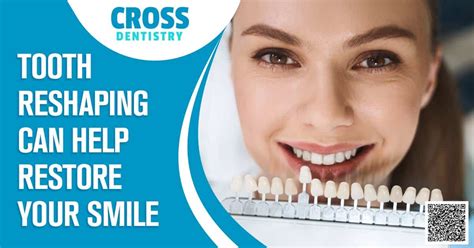 Tooth Reshaping To Restore Your Smile Cosmetic Dentistry Techniques