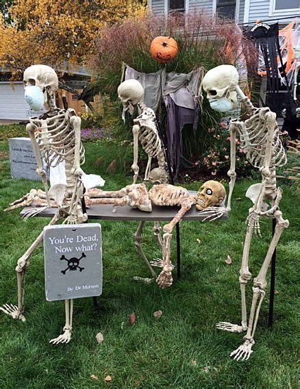 Over 19 Hilarious Skeleton Decorations For Your Yard On Halloween Kid