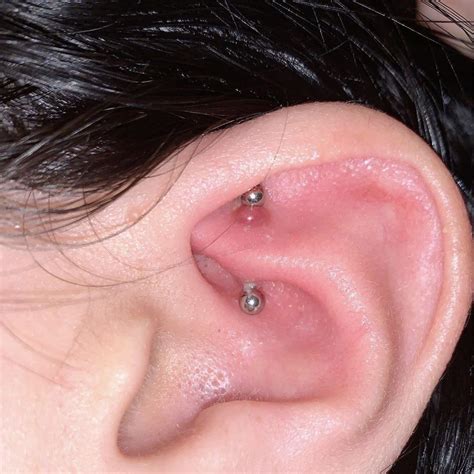 Help Keloid Or Infection On My Rook Any Suggestions Rpiercing