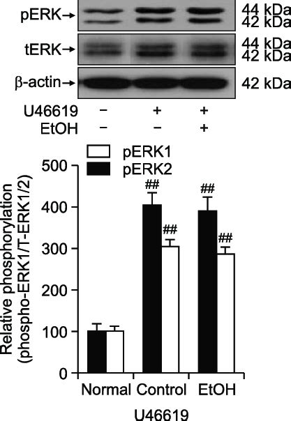 The Phospho Erk12 Protein Levels In Quick Frozen Ethanol Added Rat
