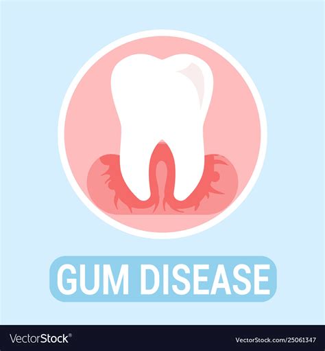 Gums Disease Dentistry Flat Banner Concept Vector Image
