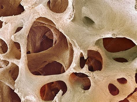 Bone Tissue Sem Stock Image P1050216 Science Photo Library