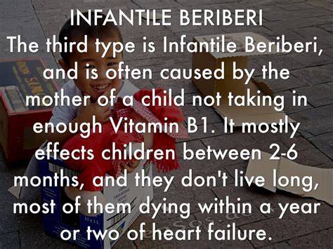 Images Of Beriberi Disease