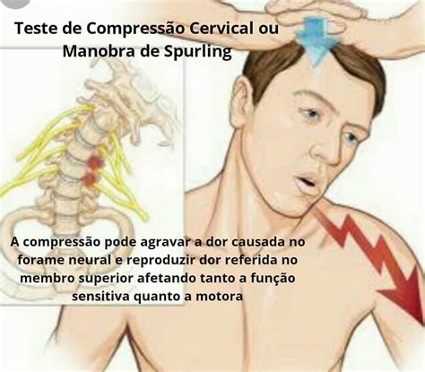 Você Sabe O Que é Teste De Spurling Itc Vertebral