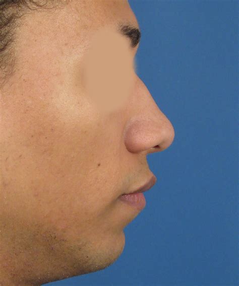 Male Nose Side Profile